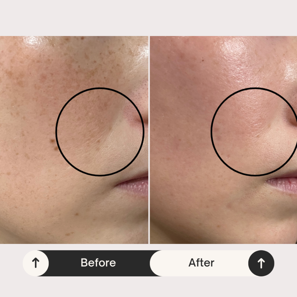 カレントボディLEDレッドライトセラピーフェイスマスク:シリーズ2