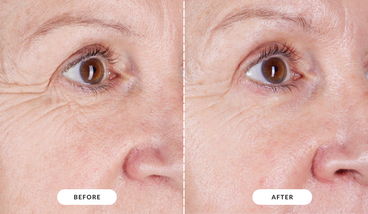 カレントボディLEDマスクシリーズ2