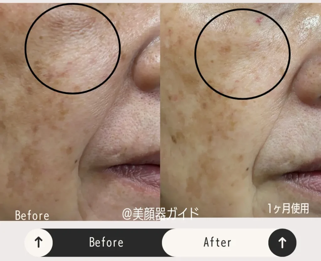 50代が1ヶ月使用：カレントボディLEDマスクの効果