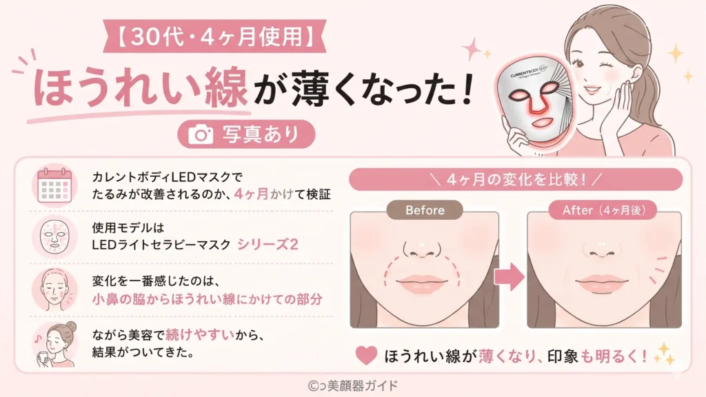【30代】カレントボディLEDマスク4か月使用でほうれい線が薄くなった