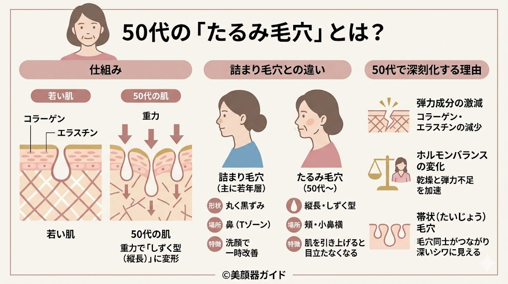 たるみ毛穴とは？