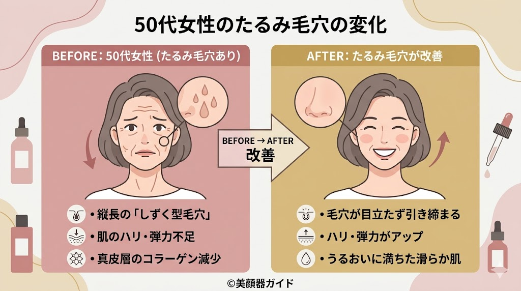 50代がカレントボディLEDマスクを1ヶ月使用-たるみ毛穴の変化