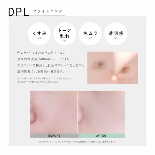 アンドクレアージュフォトスキンデバイス