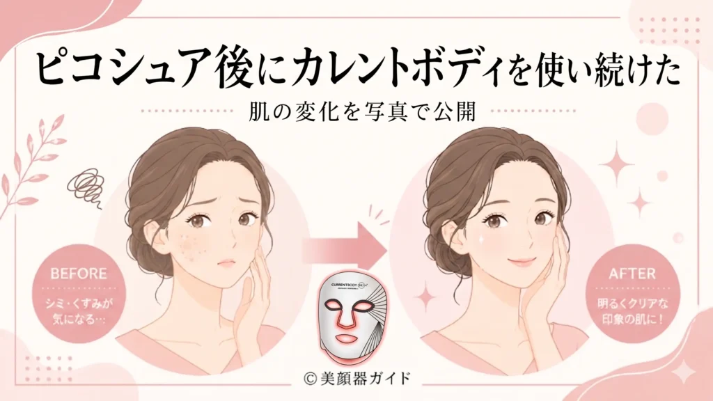 ピコシュア後にカレントボディを使い続けた肝斑・シミ肌の変化を写真で示す画像