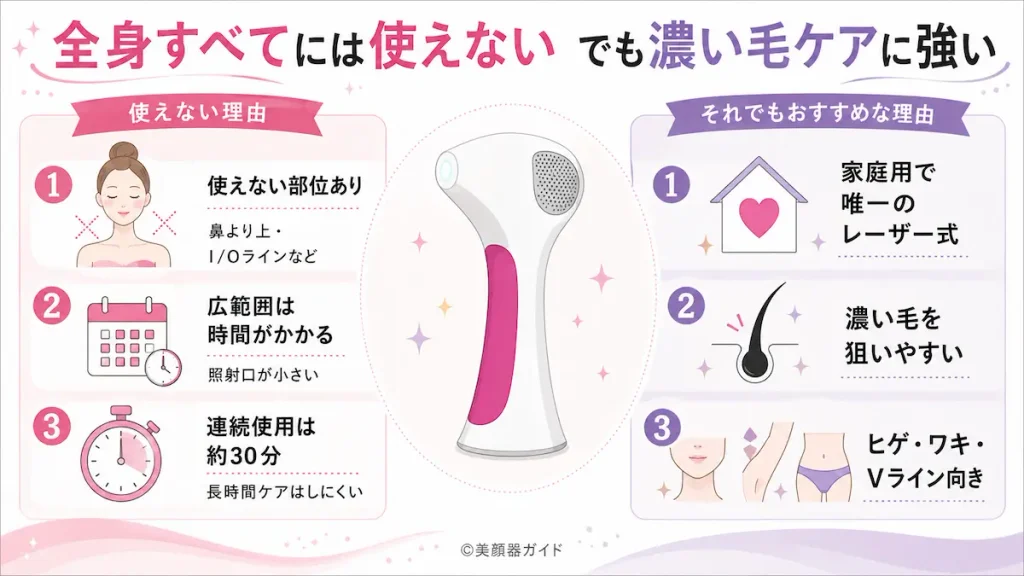トリア4Xで完全な全身脱毛はできない！それでもおすすめできるのは唯一の「レーザー式」だから